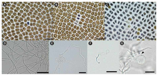 Pythium porphyrae의 감염과정과 분리배양에 따른 유성생식 (뉴질랜드) A Pyropia plicata after 1 day. B 3 days. C 9 days. Dark cells are newly infected, light cells were older infected cells, after 9 days almost all cells are dead. P. porphyrae hyphae between cells visible. D Free hyphae in Arasaki B Medium. E Hyphae swelling. F Germinating spore, with emergent germ tube and empty spore body. G Oogonium, with a single oospore, with attached antheridium (arrowhead). Scale bars represent: A-D  E & G, 20 μm. (Diehl N., Kim G.H., Zuccarello G.C., 2017)