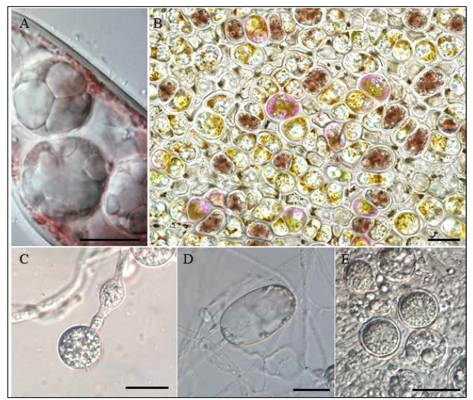 채집된 난균강 원생생물 A. Olpidiopsis heterosiphoniae sp. nov. B. Olpidiopsis pyropiae 2. C. Pythium porphyrae 2. D. Pythium porphyrae 3. E. Pythium porphyrae 4. Scale bar=20 ㎛