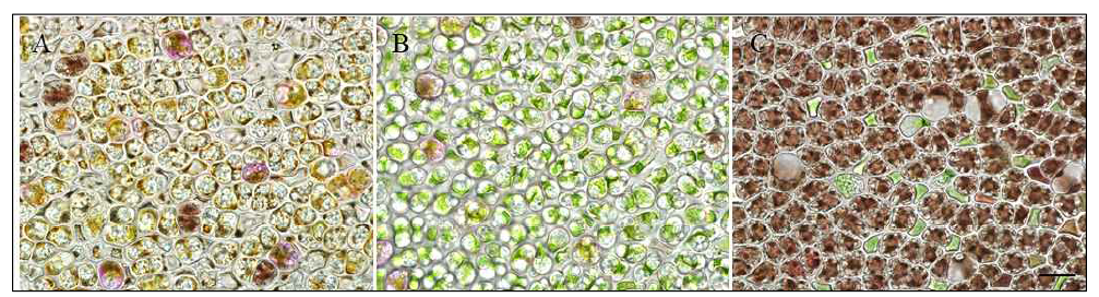 Olpidiopsis의 감염에 따른 숙주의 형태적 차이. A. Olpidiopsis pyropiae 2. B. Olpidiopsis var. koreanae. C. Olpidiopsis sp