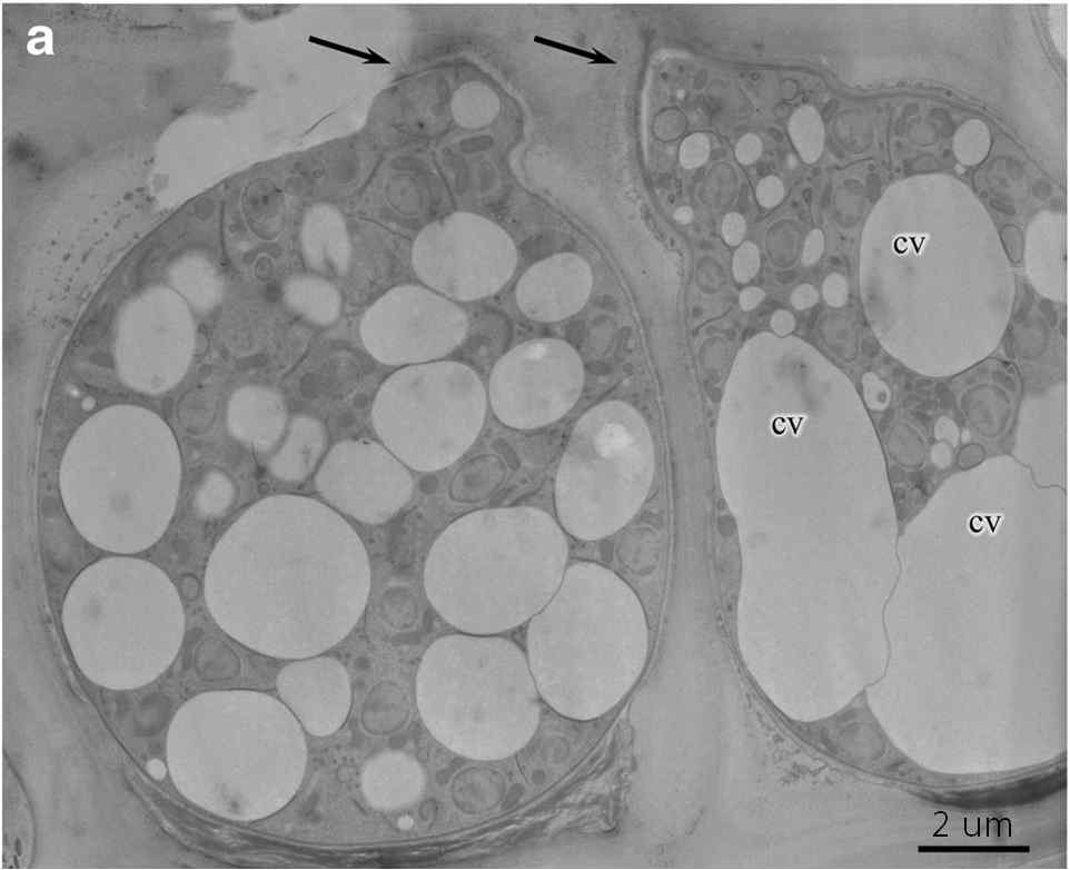 Olpidiopsis porpyrae var koreanae의 유주자 방출관 발달