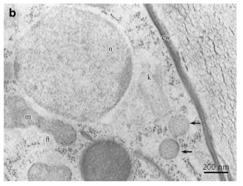 Olpidiopsis porpyrae var koreanae의 분류학적 특성 분석 쌍으로 발견되는 K-body 유사 구조 (화살표)와 섬모관을 포함하는 시스너테와 관련된 미토콘드리아가 핵 옆에 위치해 있음. cw cell wall of presporangium, ft flimmer tubules, k kinetosome, m mitochondrion, n nucleus