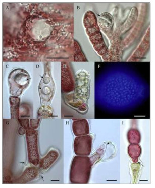 Olpidiopsis heterosiphoniae에 감염된 Heterosiphonia pulchara와 Heterosiphonia japonica A. 감염초기 숙주 세포내 유주자의 발달. B. 숙주의 정단세포에 감염된 Olpidiopsis heterosiphoniae의 유주자낭. C–D. 감염에 따른 숙주세포의 변화 팽창. E. 유주자가 방출된 후 방출관이 형성된 숙주세포. F. DAPI 염색을 통해 관찰한 유주자낭 내 Olpidiopsis heterosiphoniae 핵. G. 감염 이후 숙주세포의 변형. H–I. 감염 이후 숙주의 세포 형성. Scales=10 μm (A–C), 20 μm (D–I). (Klochkova et al. 2017)