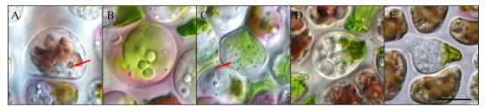 난균강 원생생물 Olpidiopsis의 감염과 발달 A. Olpidiopsis 유주자가 감염된 Pyropia의 세포 B. 숙주 세포 내에서 발달된 Olpidiopsis의 유주자낭. C. 유주자의 핵분열. D. 방출관 생성 전 다수의 소낭 형성. E. 유주자를 방출하기 위해 방출관이 생성된 유주자낭. Scale bar = 10 μm