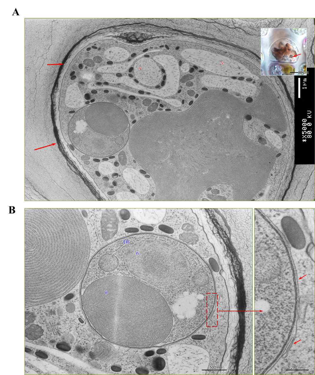 숙주의 Olpidiopsis 감염에 따른 세포 형태학적 변화 분석. A. Olpidiopsis 감염 초기 숙주세포의 세포막의 변화. B. 숙주 내부로 내포 (endocytosis)된 Olpidiopsis 유주자의 외부 막 구조