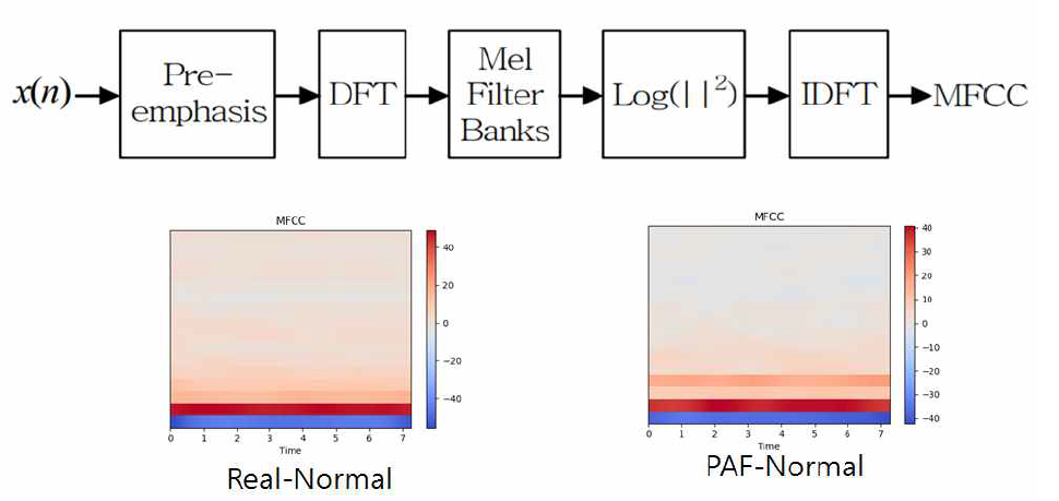 MFCC로 변환한 예 (Real-Normal 심전도와 발작성 심방세동환자가 가지는 정상 심전도의 차이)