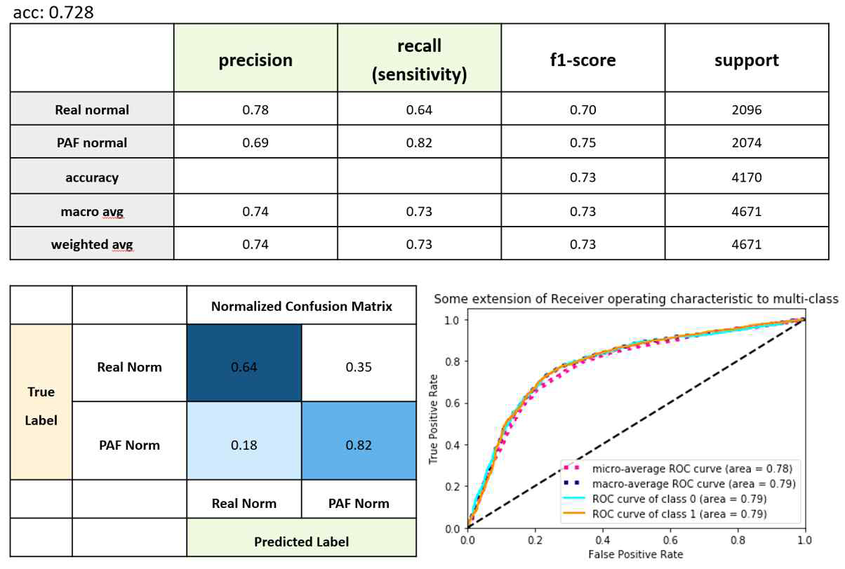 본 연구진에 의해 개발된 인공지능 심방세동 예측도 프로그램 성능 (AI deep learning algorithm Performance to predict PAF)