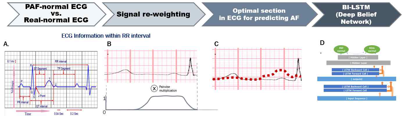 Optimal section detection for AF prediction during NSR