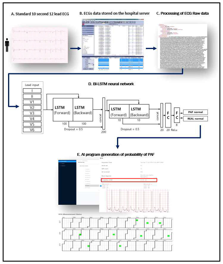 흐름도 (Inha AI ECG algorithm system to detect PAF)