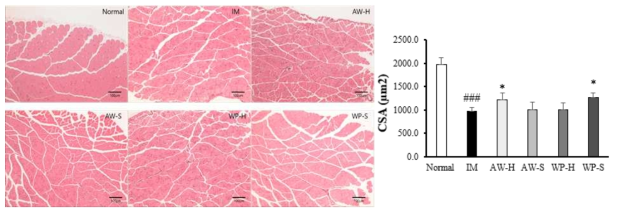 근육 조직(Gastrocnemius) H&E 염색 사진 (100x)과 근섬유 단면적