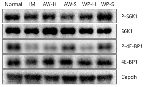 p-S6K1, S6K1, p-4E-BP1, 4E-BP1의 단백질 발현