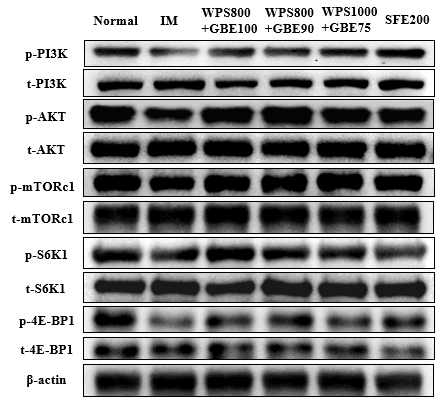 p-PI3K, PI3K, p-Akt, Akt, p-mTOR, mTOR,p-S6K1, S6K1, p-4E-BP1, 4E-BP1의 단백질 발현