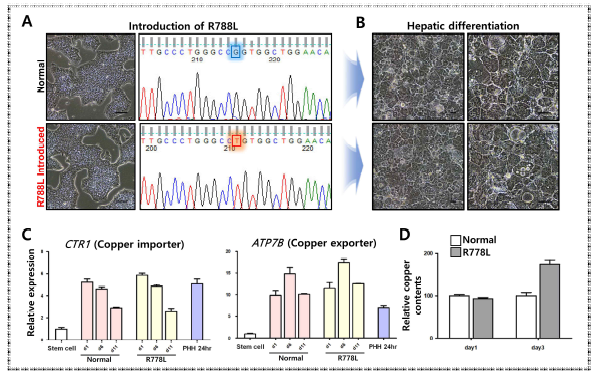 윌슨병 전분화능 줄기세포 제작 및 분화된 간세포의 질환 표현형적 특성 분석
