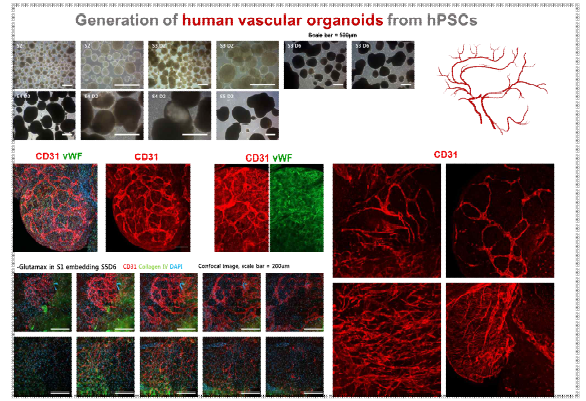분화 혈관세포를 이용한 혈관오가노이드 형성