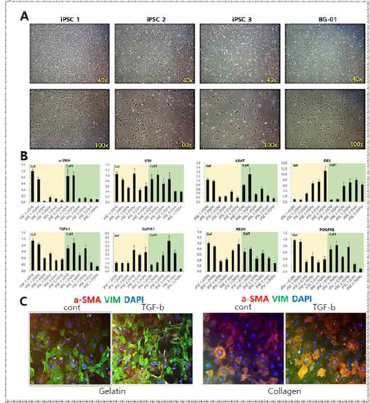 CD31 negative cell의 TGFb 처리를 통한 activation 검증