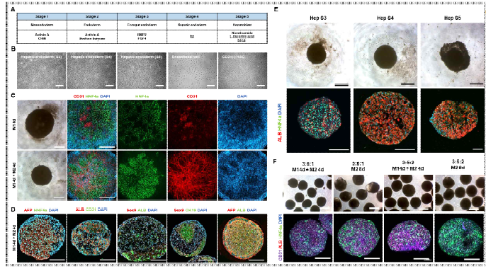복합세포 조립을 통한 신규 간오가노이드 형성 기법 확립 (Scale bar = 200μm)