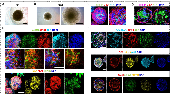 복합세포 간오가노이드 형성 기법 최적화 (Scale bar = 200μm, A, B, C, D, F / Scale bar = 50μm, E)