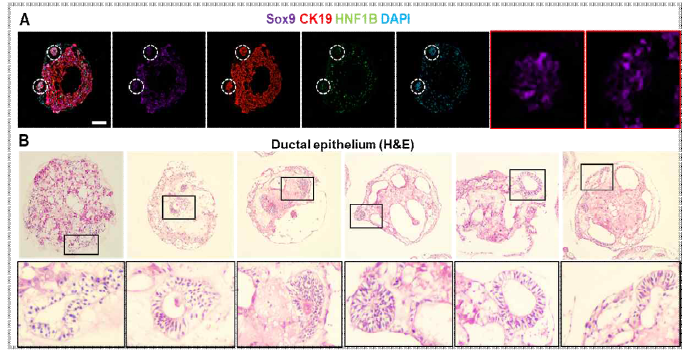 복합세포 간오가노이드 내 담관 구조 형성에 대한 조직학적 검증