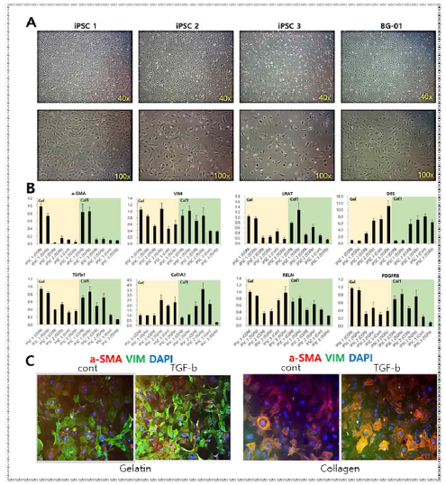 CD31 negative population cell의 hepatic lineage 분화 정도 분석 및 TGFb 처리를 통한 activation 검증