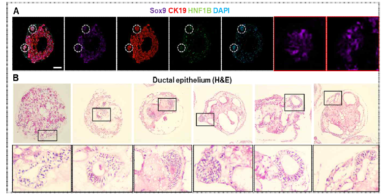 복합세포 간오가노이드 내 담관 구조 형성에 대한 조직학적 검증