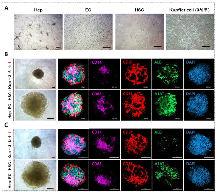 쿠퍼면역세포 포함 4종 복합세포 간오가노이드 형성 및 비율 최적화 (Scale bar: 200 μm)