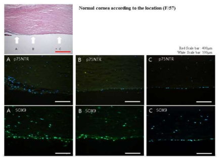 정상 각막에서 각막내피전구세포의 위치 분포