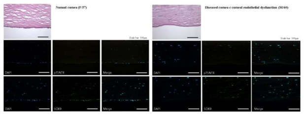 정상 및 질환 각막에서 각막내피전구세포의 밀도 비교