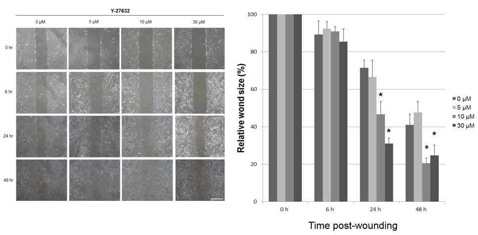 Y-27632 처리 하에 상처 치유 회복 능력 증가