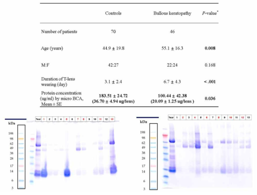 치료용 렌즈에서 추출된 단백질 양과 종류 비교