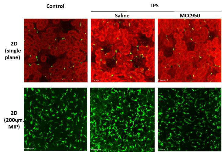 LPS 유발 급성신손상 신장에서 신장내 CD11c 세포의 변화