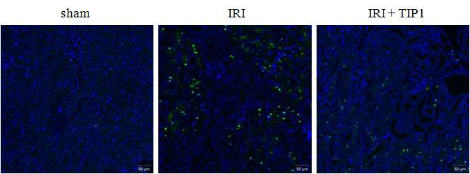CD11c mice 허혈재관류 신손상 모델에서 TIP1이 CD11c 양성세포에 미치는 영향