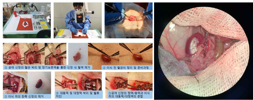 mice 신장이식 모델의 미세현미경 수술 과정과 재관류후 이식신의 모습