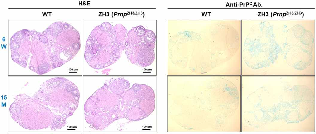 Characterization of ovaries in 6-week and 15-month old wild type or C57BL/6J-PrnpZH3/ZH3 mice by H&E staining and immunohistochemistry