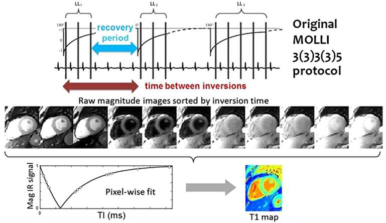 심장에서 T1 자기이완율 맵을 얻기 위한 대표적인 MOLLI (Modified Look-Locker Inversion Recovery) sequence 방식에 대한 설명