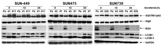 Western blot analysis of autophagy markers upon 10 μM sorafenib treatment