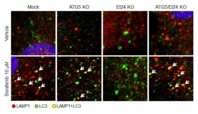 Autophagy 마커들을 이용한 면역형광염색법을 통해 autophagy 확인