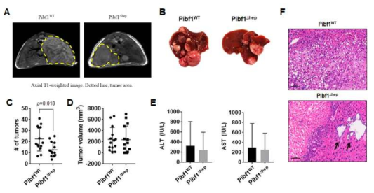 간암 마우스모델에서 WT과 간세포 특이적 Pibf1 KO 마우스 차이 분석