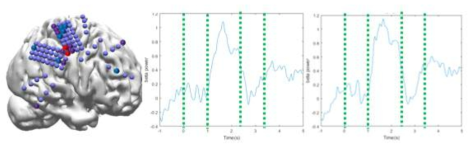 촉감각 작업기억 해당 영역(좌) 영역에서의 Beta wave(중,우)