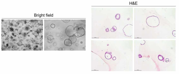 신장 조직 유래의 3D 오가노이드의 형태학적 분석 및 H&E 염색 결과