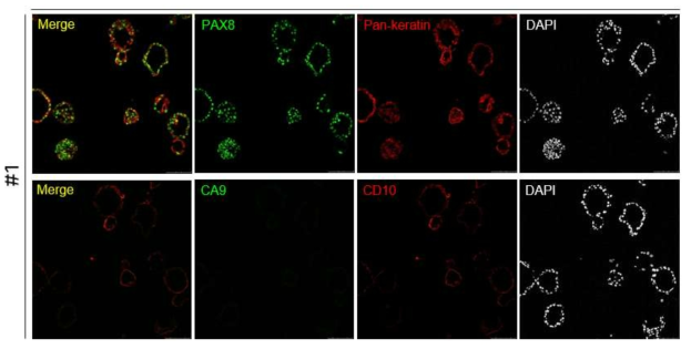 신장 조직 유래의 3D 오가노이드에서 신장 특이 마커에 대한 면역형광염색 결과