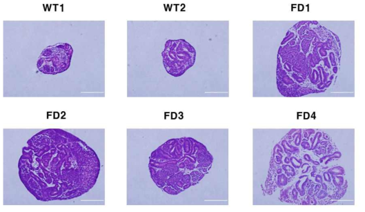 H&E staining in kidney organoids (정상 및 Fabry 질환 환자 유래)