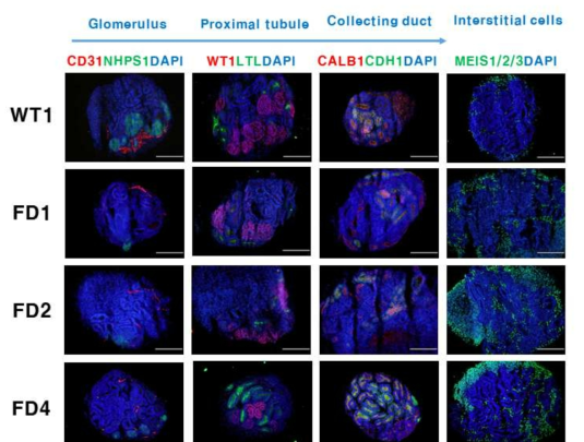 Immunostaining in kidney organoids (정상 및 Fabry 질환 환자 유래)