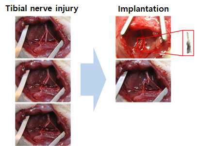 Surgical procedure