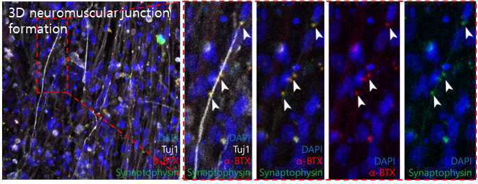 면역형광염색을 통한 신경/근육 접합형성 바이오마커 확인