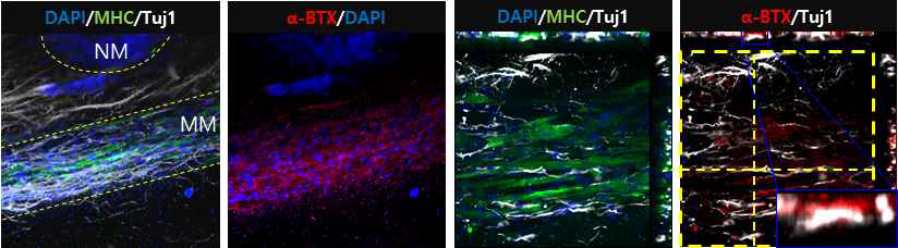 면역형광염색을 통한 신경/근육 접합형성 바이오마커 확인
