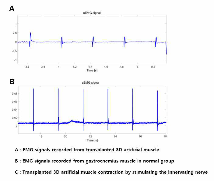 ECM 신호 측정을 통한 in vivo 신경/in vitro 인공 근육 접합 모델 평가