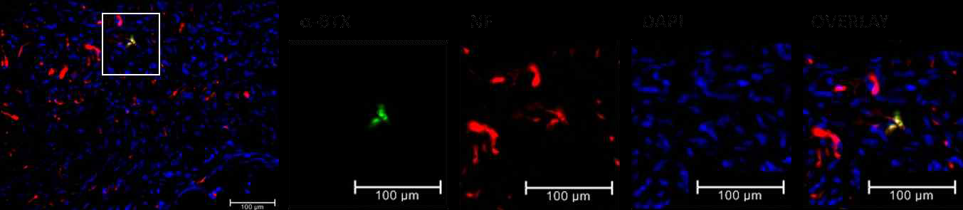 형광면역조직화학법 기반 신경/근육 특이적 마커 염색을 통한 in vivo 신경/in vitro 근육 구조체 접합 평가