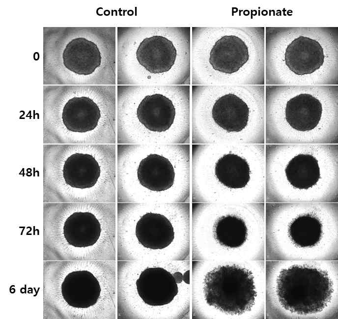 대장암 세포주의 3D spheroid의 Propionate처리를 통한 암 억제 효과 확인