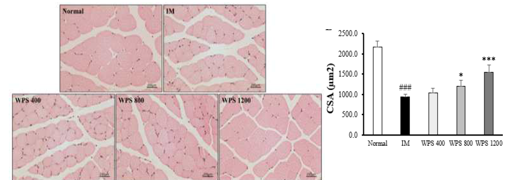 근육 조직(Gastrocnemius) H&E 염색 사진 (100x)과 근섬유 단면적