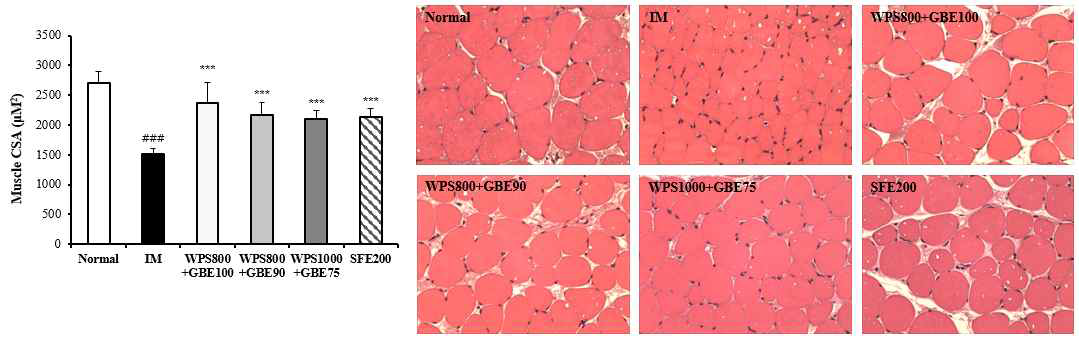 근육 조직(Gastrocnemius) H&E 염색 사진 (100x)과 근섬유 단면적