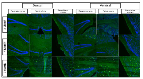 5xFAD Tg mouse에서 senile plaque 형성 생후 3개월부터 보이며 ventral hippocampus, subiculum에서 좀 더 많이 보임